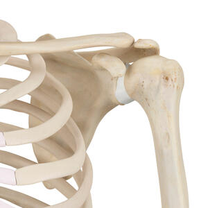 lesione rotatori lesione rotatori